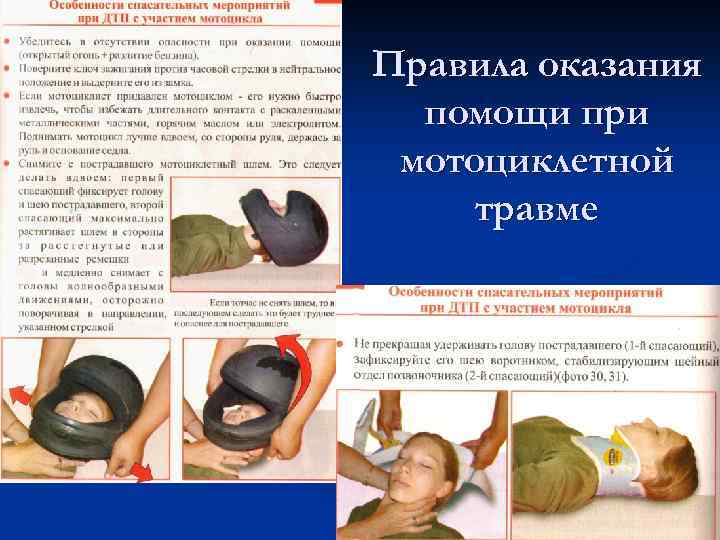Правила оказания помощи при мотоциклетной травме 