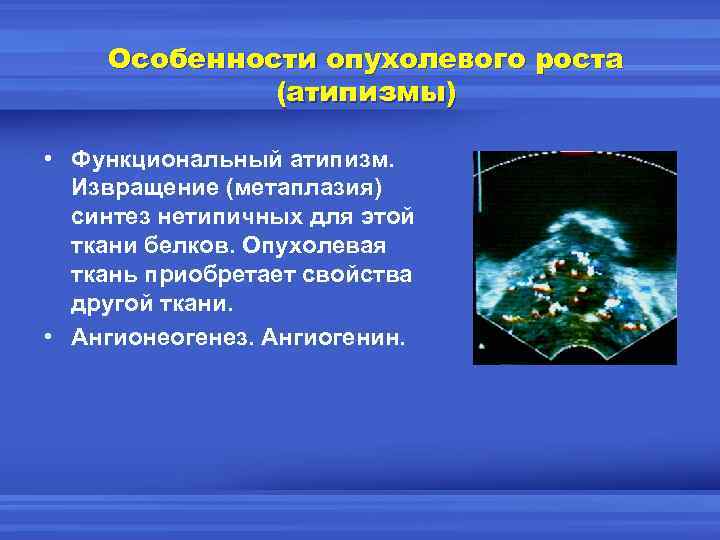 Особенности опухолевого роста (атипизмы) • Функциональный атипизм. Извращение (метаплазия) синтез нетипичных для этой ткани