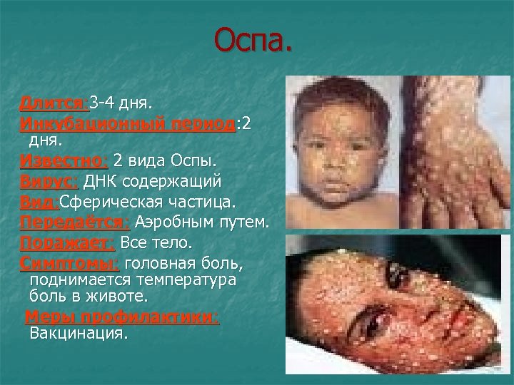 Оспа. Длится: 3 -4 дня. Инкубационный период: 2 дня. Известно: 2 вида Оспы. Вирус: