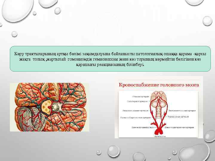 Көру трактыларының артқы бөлімі зақымдалуына байланысты патологиялық ошаққа қарама -қарсы жақта толық , жартылай