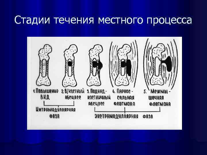 Стадии течения