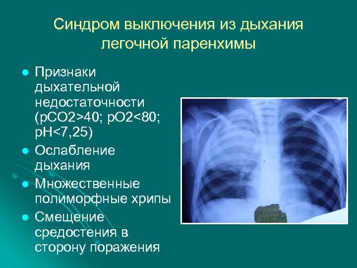 Деструктивная пневмония у детей презентация