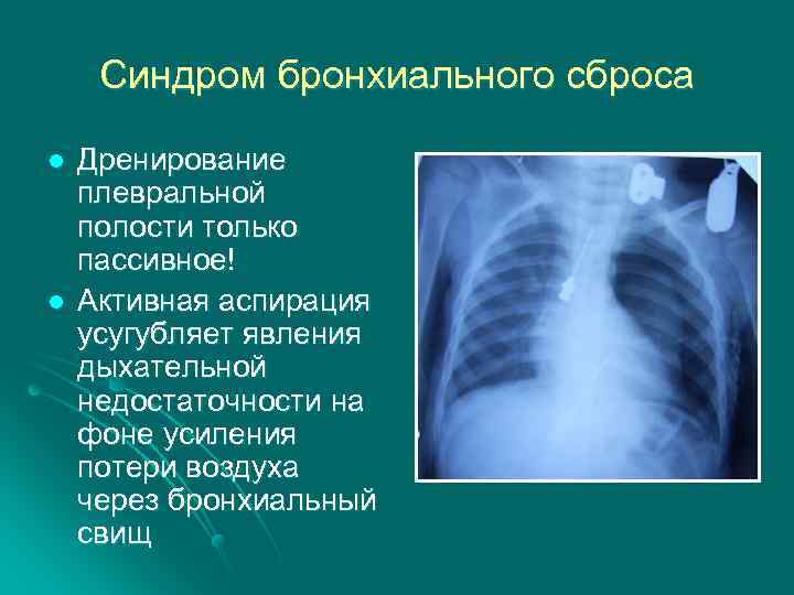 Синдром бронхиального сброса l l Дренирование плевральной полости только пассивное! Активная аспирация усугубляет явления