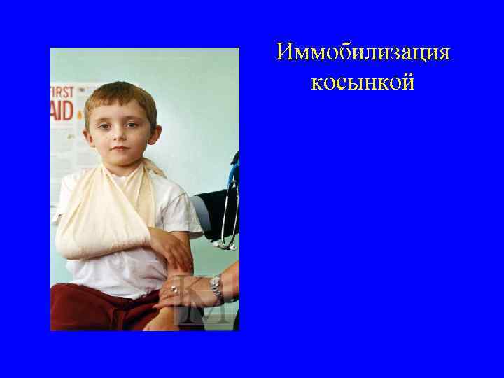 Иммобилизация косынкой 