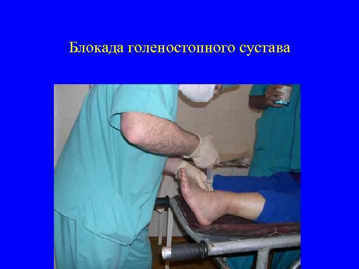 Блокада голеностопного сустава 