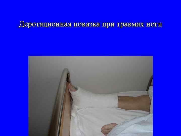 Деротационная повязка при травмах ноги 