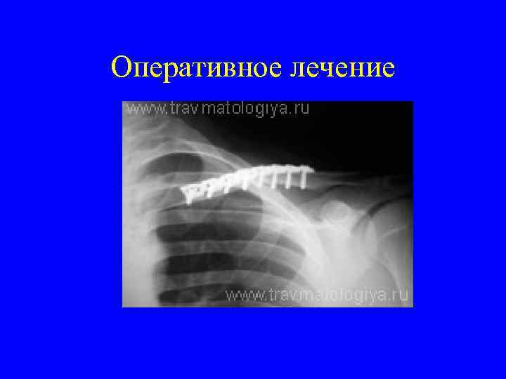 Оперативное лечение 