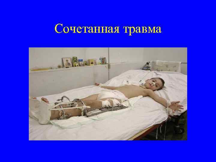 Сочетанная травма 