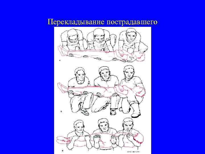 Перекладывание пострадавшего 