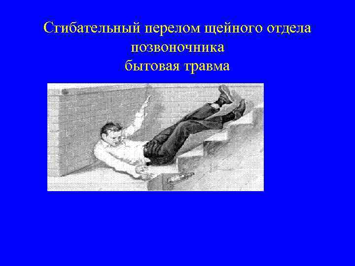 Сгибательный перелом щейного отдела позвоночника бытовая травма 