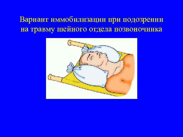 Вариант иммобилизации при подозрении на травму шейного отдела позвоночника 