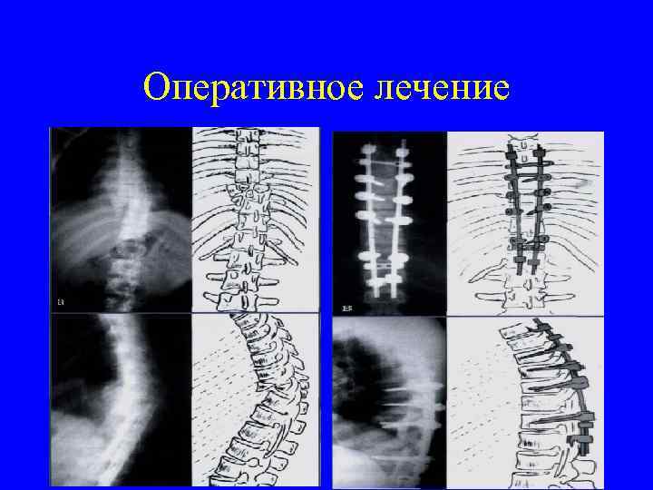 Оперативное лечение 