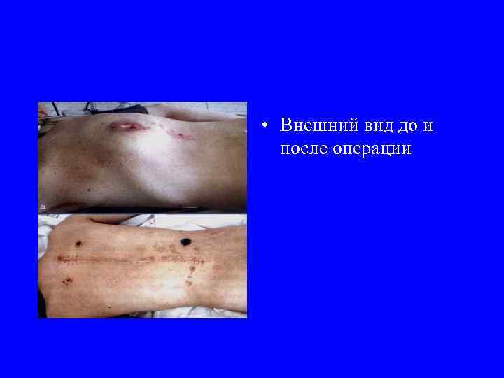  • Внешний вид до и после операции 