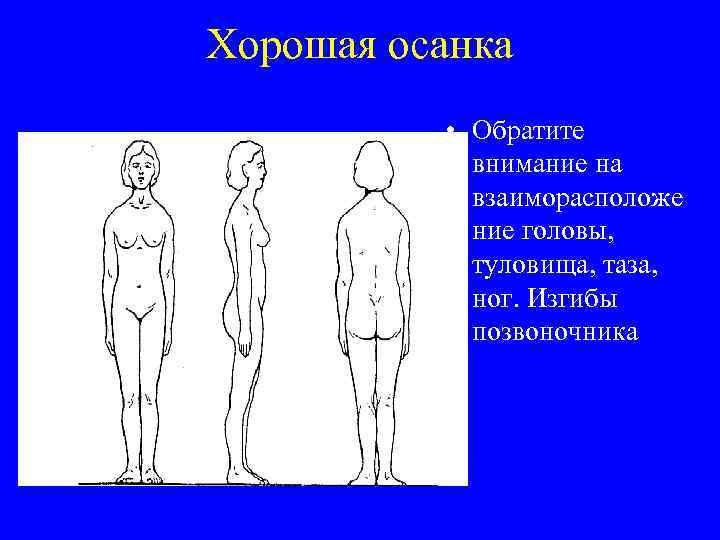 Хорошая осанка • Обратите внимание на взаиморасположе ние головы, туловища, таза, ног. Изгибы позвоночника