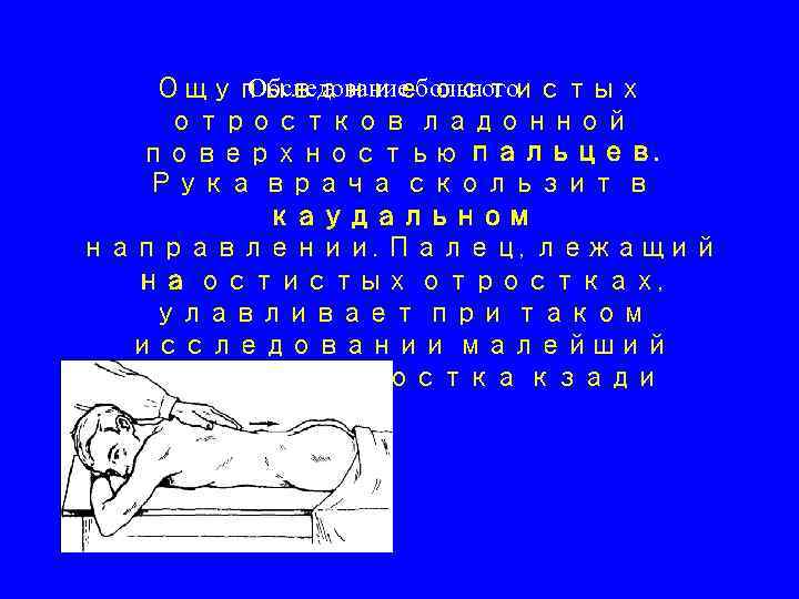  Обследование больного Ощупывание остистых отростков ладонной поверхностью пальцев. Рука врача скользит в каудальном