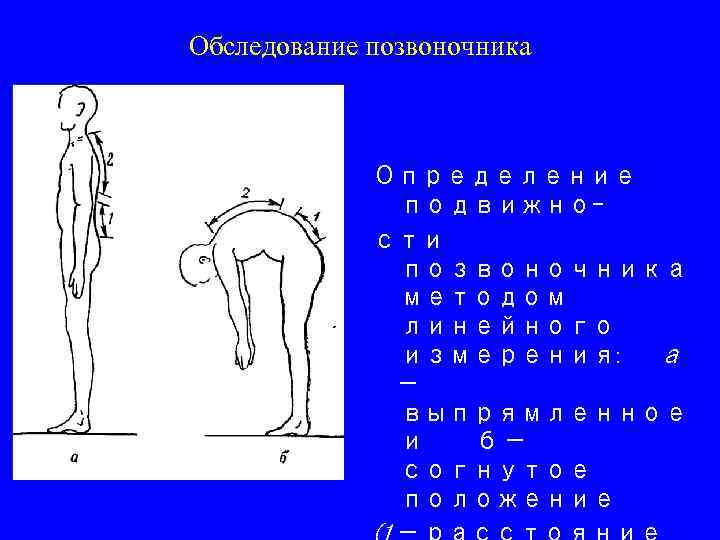 Обследование позвоночника Определение подвижности позвоночника методом линейного измерения: а — выпрямленное и б— согнутое