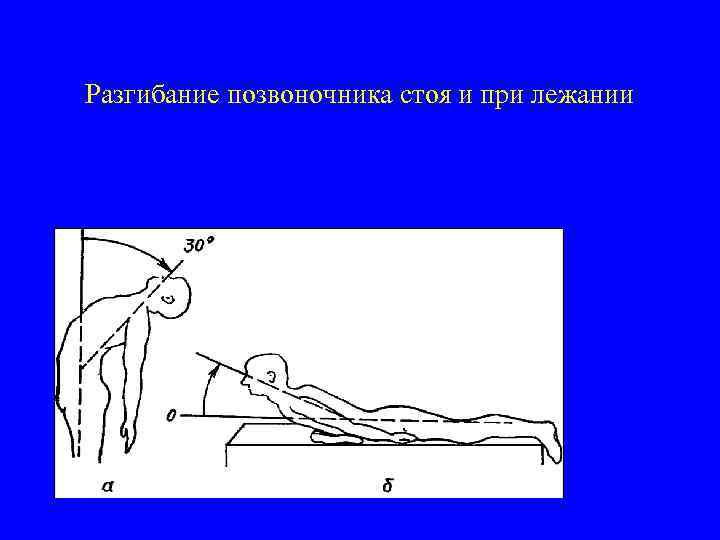 Разгибание позвоночника стоя и при лежании 