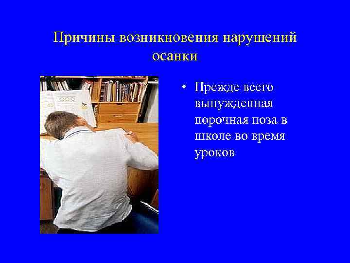 Причины возникновения нарушений осанки • Прежде всего вынужденная порочная поза в школе во время