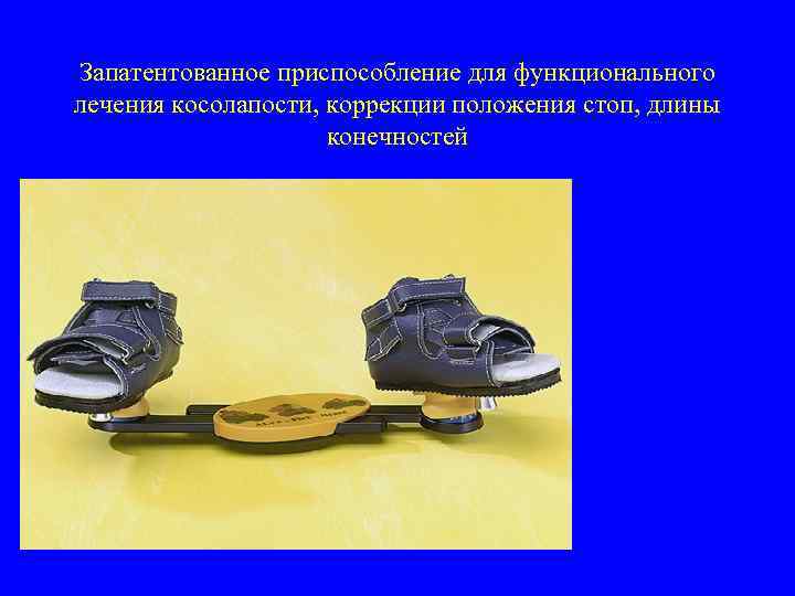 Запатентованное приспособление для функционального лечения косолапости, коррекции положения стоп, длины конечностей 