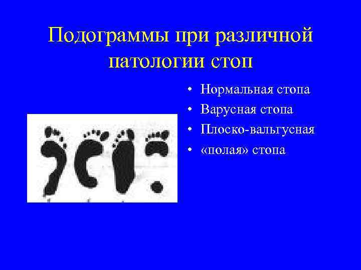 Подограммы при различной патологии стоп • • Нормальная стопа Варусная стопа Плоско-вальгусная «полая» стопа