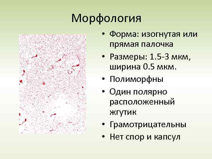 Морфология • Форма: изогнутая или прямая палочка • Размеры: 1. 5 -3 мкм, ширина