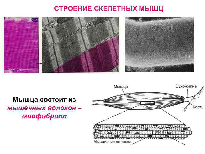 Нарисуйте электрограмму мпп скелетно мышечного волокна