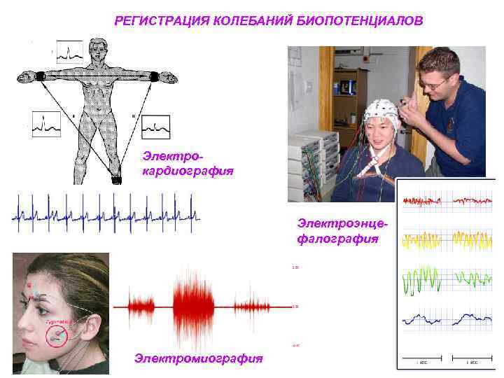 РЕГИСТРАЦИЯ КОЛЕБАНИЙ БИОПОТЕНЦИАЛОВ Электрокардиография Электроэнцефалография Электромиография 