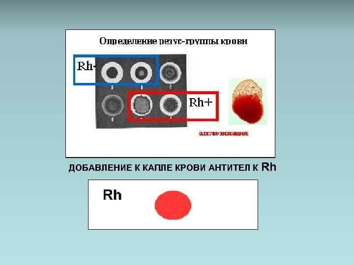 ДОБАВЛЕНИЕ К КАПЛЕ КРОВИ АНТИТЕЛ К Rh 