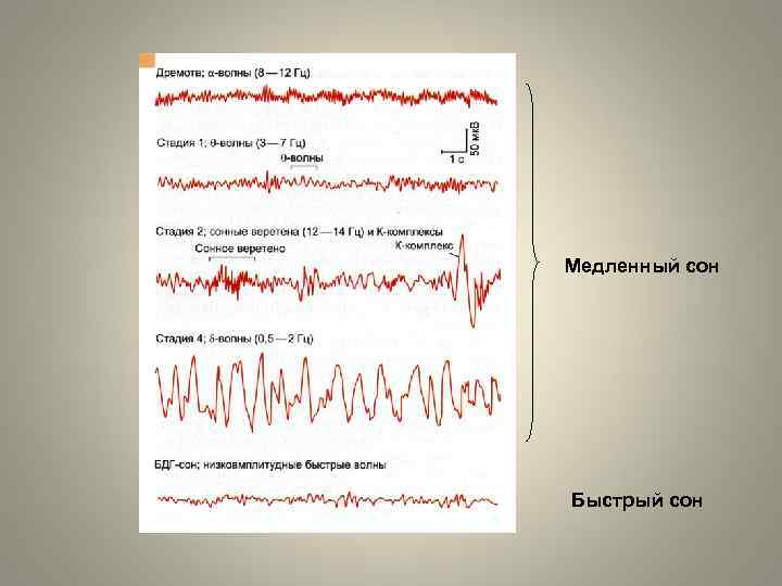 Медленный сон Быстрый сон 