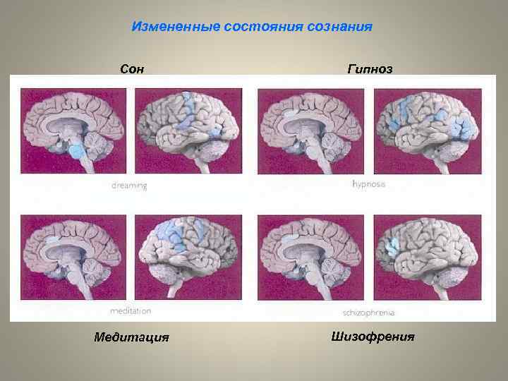 Измененные состояния сознания Сон Гипноз Медитация Шизофрения 