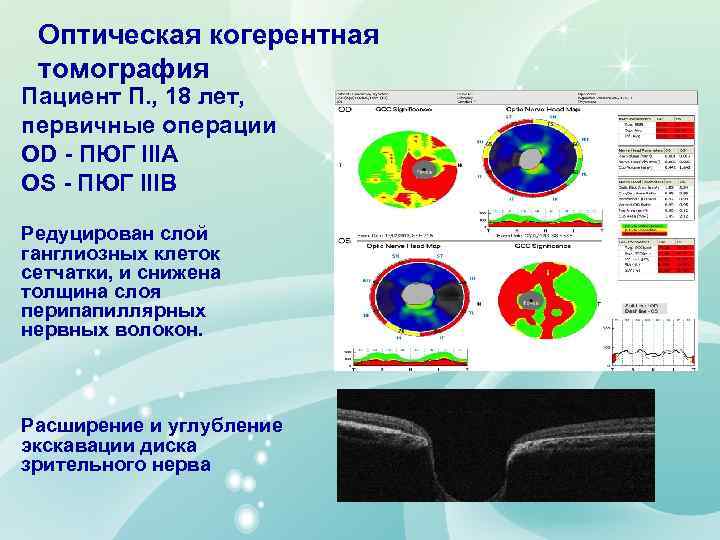 C первичные операции