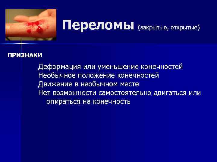 Переломы (закрытые, открытые) ПРИЗНАКИ Деформация или уменьшение конечностей Необычное положение конечностей Движение в необычном