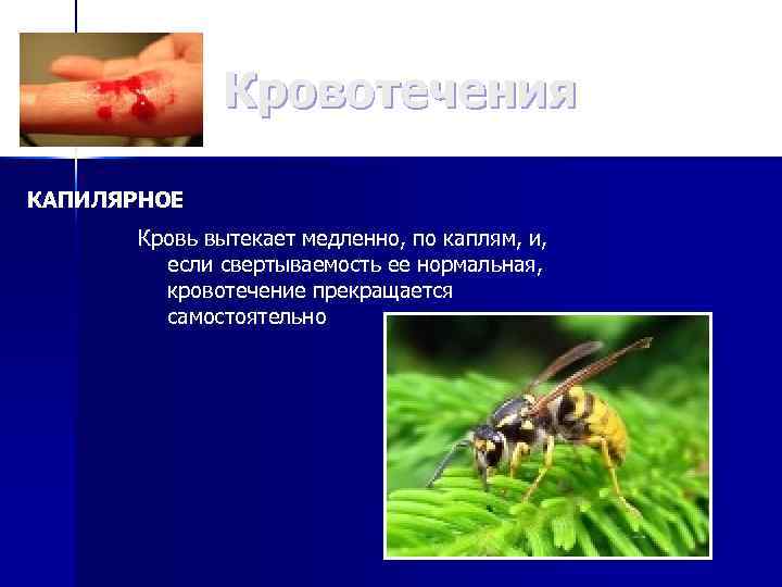 Кровотечения КАПИЛЯРНОЕ Кровь вытекает медленно, по каплям, и, если свертываемость ее нормальная, кровотечение прекращается