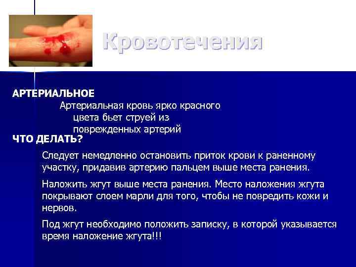 Кровотечения АРТЕРИАЛЬНОЕ Артериальная кровь ярко красного цвета бьет струей из поврежденных артерий ЧТО ДЕЛАТЬ?