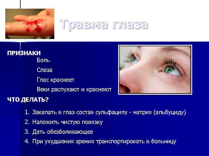 Травма глаза ПРИЗНАКИ Боль Слеза Глас краснеет Веки распухают и краснеют ЧТО ДЕЛАТЬ? 1.