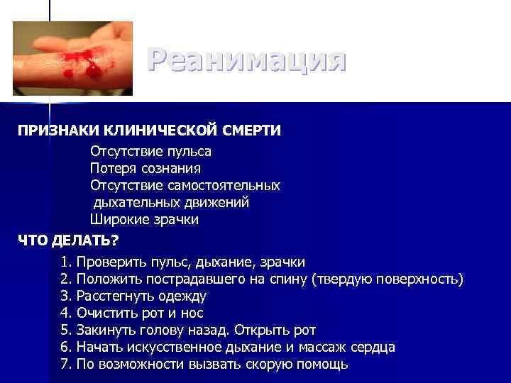 Реанимация ПРИЗНАКИ КЛИНИЧЕСКОЙ СМЕРТИ Отсутствие пульса Потеря сознания Отсутствие самостоятельных дыхательных движений Широкие зрачки