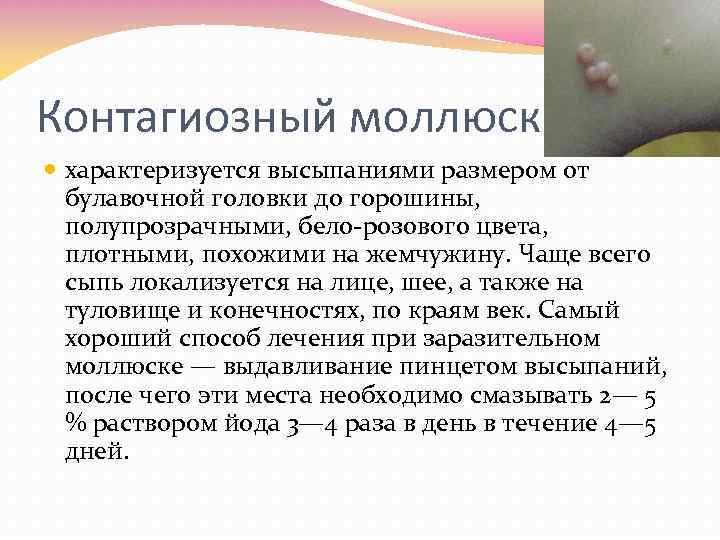 Контагиозный моллюск характеризуется высыпаниями размером от булавочной головки до горошины, полупрозрачными, бело розового цвета,