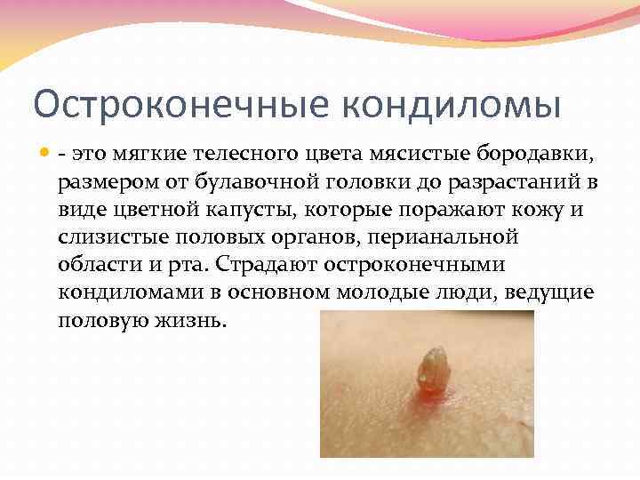 Остроконечные кондиломы это мягкие телесного цвета мясистые бородавки, размером от булавочной головки до разрастаний