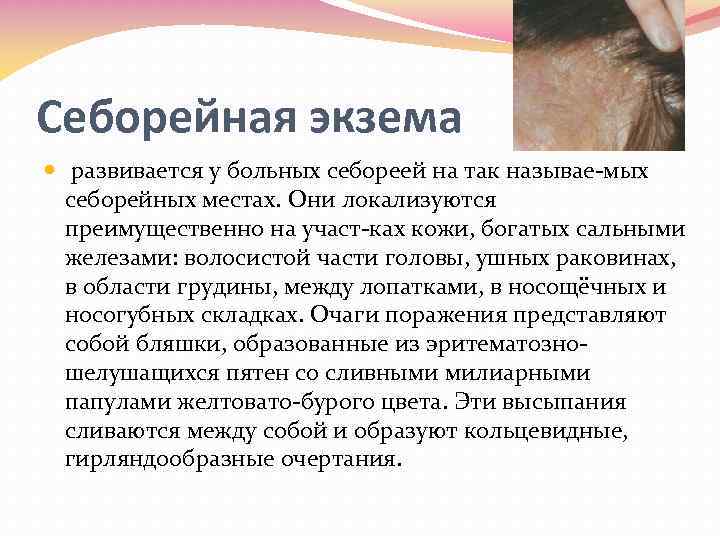 Себорейная экзема развивается у больных себореей на так называе мых себорейных местах. Они локализуются