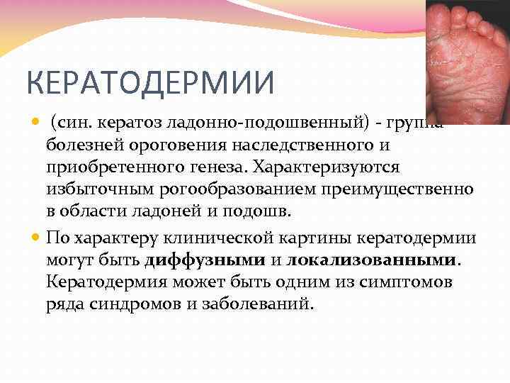 КЕРАТОДЕРМИИ (син. кератоз ладонно подошвенный) группа болезней ороговения наследственного и приобретенного генеза. Характеризуются избыточным