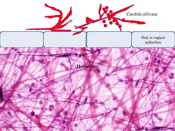 Candida albicans Oral or vaginal epithelium Цитокины IL-1α GM-CSF IL-1β IL-6 Фибробласт IL-8 Тучная
