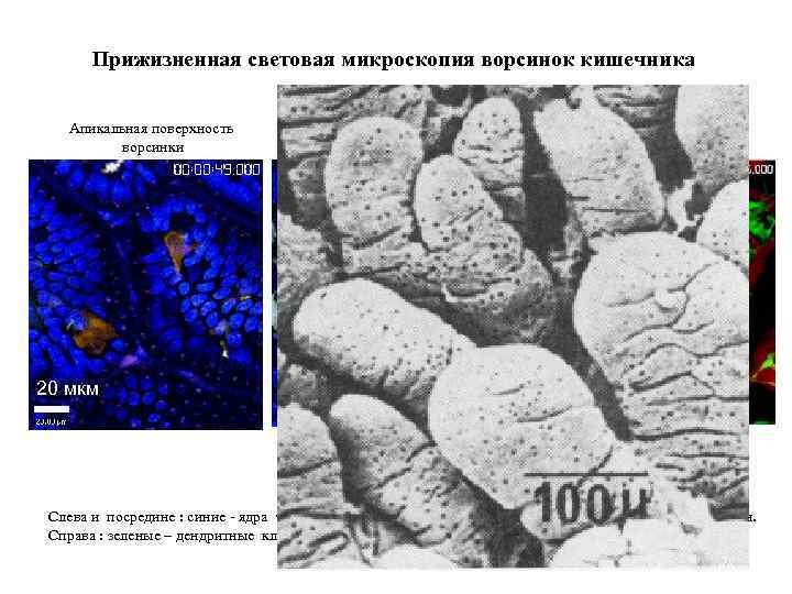 Прижизненная световая микроскопия ворсинок кишечника Апикальная поверхность ворсинки 20 мкм Чуть глубже, 10 -20