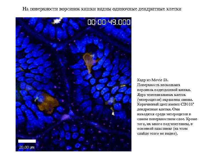 На поверхности ворсинок кишки видны одиночные дендритные клетки Кадр из Movie S 3. Поверхность