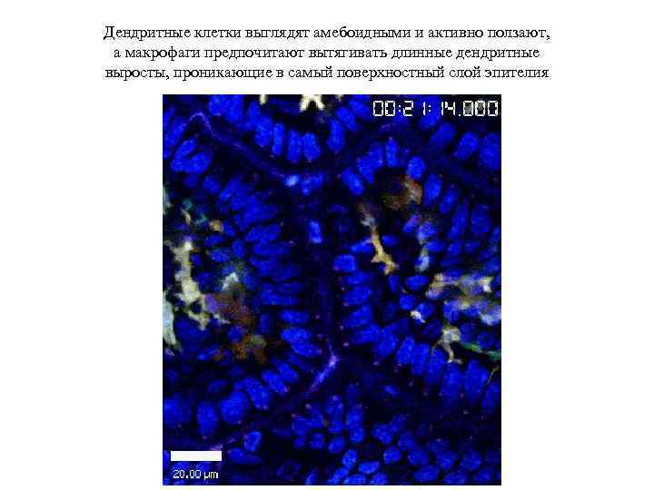 Дендритные клетки выглядят амебоидными и активно ползают, а макрофаги предпочитают вытягивать длинные дендритные выросты,