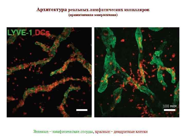 Архитектура реальных лимфатических капилляров (прижизненная микроскопия) 100 мкм DC облепили лимфатические капилляры (слева), DC