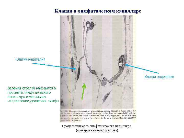 Клапан в лимфатическом капилляре Клетка эндотелия Зеленая стрелка находится в просвете лимфатического капилляра и