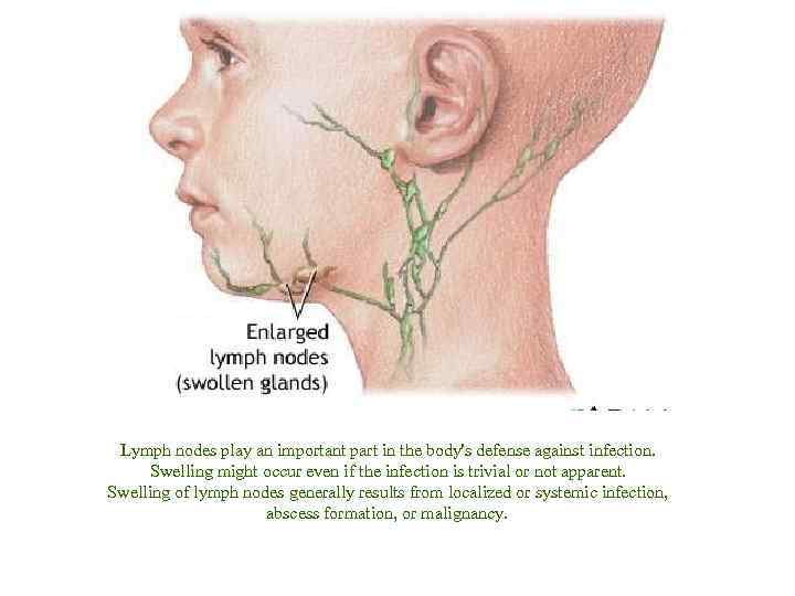 Lymph nodes play an important part in the body's defense against infection. Swelling might