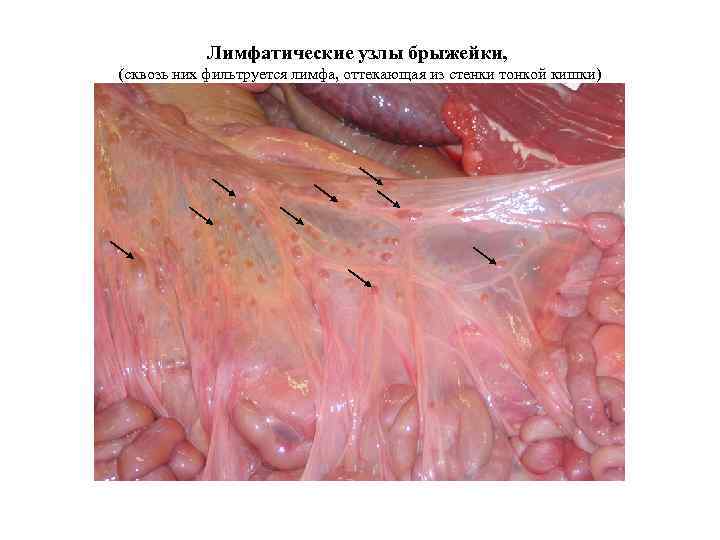 Лимфатические узлы брыжейки, (сквозь них фильтруется лимфа, оттекающая из стенки тонкой кишки) 