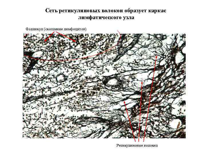 Сеть ретикулиновых волокон образует каркас лимфатического узла Фолликул (скопление лимфоцитов) Ретикулиновые волокна 