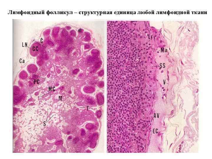 Лимфоидный фолликул – структурная единица любой лимфоидной ткани 